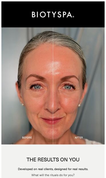 Real Customers, Real Results 💥 - email from Biotyspa